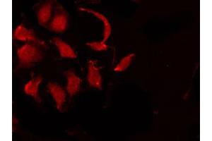 Immunofluorescence (fixed cells) (IF/ICC) image for anti-Inhibitor of kappa Light Polypeptide Gene Enhancer in B-Cells, Kinase gamma (IKBKG) (pSer31) antibody (ABIN6255189)