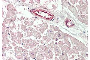 Rabbit Anti-KCNIP2 antibody  Formalin Fixed Paraffin Embedded Tissue: Human Heart Primary antibody Concentration: 1:100 Secondary Antibody: Donkey anti-Rabbit-Cy3 Secondary Antibody Concentration: 1:200 Magnification: 20x Exposure Time: 0. (KCNIP2 antibody  (N-Term))