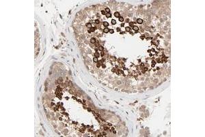 Immunohistochemical staining of human testis with RAB5C polyclonal antibody  shows strong cytoplasmic positivity in cells in seminiferus ducts at 1:50-1:200 dilution. (Rab5c antibody)