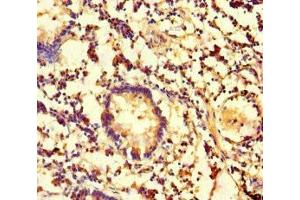 Immunohistochemistry of paraffin-embedded human appendix tissue using ABIN7146751 at dilution of 1:100 (CES3 antibody  (AA 65-233))