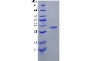 SDS-PAGE analysis of Mouse Interleukin 17C Protein.