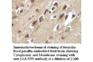 Image no. 1 for anti-Udp-N-Acetyl-alpha-D-Galactosamine:polypeptide N-Acetylgalactosaminyltransferase 9 (GalNAc-T9) (GALNT9) antibody (ABIN791210) (GALNT9 antibody)