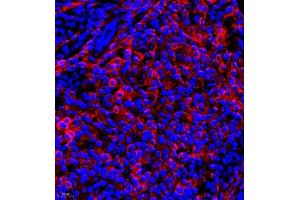 Immunofluorescence (Paraffin-embedded Sections) (IF (p)) image for anti-Dihydropyrimidinase-Like 4 (DPYSL4) antibody (ABIN7073734)
