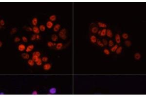 Immunofluorescence analysis of MCF7 cells using Phospho-POLR2A(S5) Polyclonal Antibody at dilution of 1:100. (POLR2A/RPB1 antibody  (pSer5))