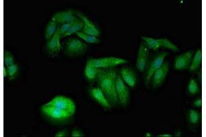 Immunofluorescent analysis of HepG2 cells using ABIN7174076 at dilution of 1:100 and Alexa Fluor 488-congugated AffiniPure Goat Anti-Rabbit IgG(H+L) (TXK antibody  (AA 32-83))