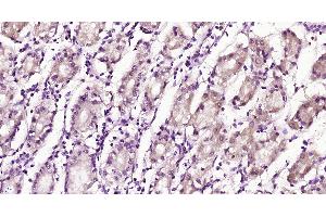 Paraformaldehyde-fixed, paraffin embedded Human stomach, Antigen retrieval by boiling in sodium citrate buffer (pH6. (LILRB2 antibody  (AA 1-100))