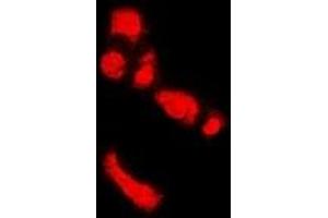 Immunofluorescent analysis of PADI4 staining in U2OS cells. (PAD4 antibody)