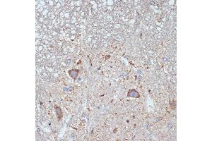 Immunohistochemistry of paraffin-embedded mouse spinal cord using CBR1 Rabbit mAb (ABIN7266076) at dilution of 1:100 (40x lens). (CBR1 antibody)