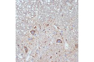 Immunohistochemistry of paraffin-embedded mouse spinal cord using CBR1 Rabbit mAb (ABIN7266076) at dilution of 1:100 (40x lens).