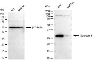 Western blotting analysis using Galectin 3 antibody (ABIN7798687). (Recombinant Galectin 3 antibody)