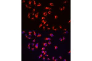 Immunofluorescence analysis of  cells using Tau antibody (ABIN3021441, ABIN3021442, ABIN3021443 and ABIN6215045) at dilution of 1:100 (40x lens). (MAPT antibody  (AA 1-100))