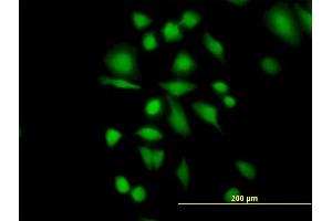 Immunofluorescence of purified MaxPab antibody to ETHE1 on HeLa cell. (ETHE1 antibody  (AA 1-254))