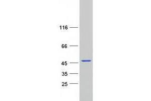 Validation with Western Blot