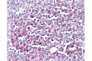 Anti-MCM5 antibody IHC of human tonsil. (MCM5 antibody)