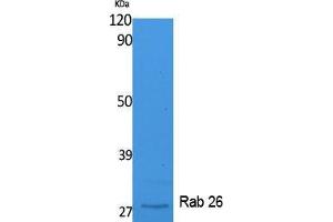 Western Blotting (WB) image for anti-RAB26, Member RAS Oncogene Family (RAB26) (C-Term) antibody (ABIN3178106) (RAB26 antibody  (C-Term))