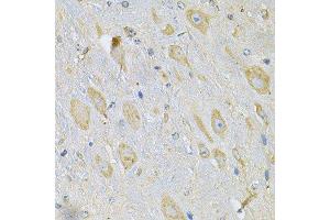 Immunohistochemistry of paraffin-embedded mouse brain using TXNDC5 Antibody. (TXNDC5 antibody  (AA 1-324))