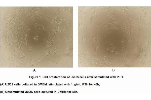 PTH Protein (AA 32-115) (MBP tag,His tag)