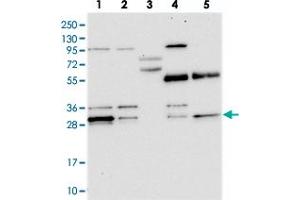 Western blot analysis of Lane 1: RT-4, Lane 2: U-251 MG, Lane 3: Human Plasma, Lane 4: Liver, Lane 5: Tonsil with PPTC7 polyclonal antibody  at 1:250-1:500 dilution. (PPTC7 antibody)