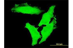 Immunofluorescence of monoclonal antibody to CHUK on HeLa cell. (IKK alpha antibody  (AA 646-745))