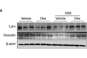Obacunone inhibited the DSS-induced loss of TJP1 and occludin protein expression.