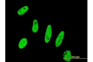 Immunofluorescence of monoclonal antibody to BIRC5 on HeLa cell. (Survivin antibody  (AA 1-100))