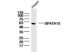 Mouse heart lysates probed with SPATA15/SPATC1 Polyclonal Antibody, Unconjugated  at 1:300 dilution and 4˚C overnight incubation. (SPATC1 antibody  (AA 1-100))