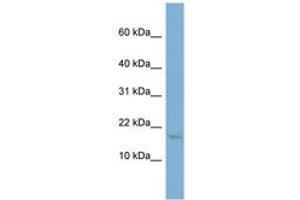 Image no. 1 for anti-Ribosomal Protein S13 (RPS13) (N-Term) antibody (ABIN6741843) (RPS13 antibody  (N-Term))
