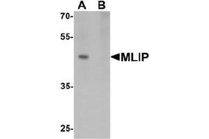 Western blot analysis of MLIP in 293 cell lysate with MLIP antibody at 1 ug/mL in (A) the absence and (B) the presence of blocking peptide. (MLIP antibody  (C-Term))