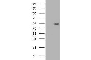 Image no. 1 for anti-Vimentin (VIM) (AA 210-466) antibody (ABIN1491207) (Vimentin antibody  (AA 210-466))