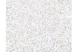 Immunohistochemistry (IHC) image for anti-Histone H3 (H3) (C-Term) antibody (ABIN7455227) (Histone 3 antibody  (C-Term))