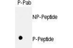 Image no. 1 for anti-Retinoblastoma 1 (RB1) (pSer811) antibody (ABIN358217) (Retinoblastoma 1 antibody  (pSer811))