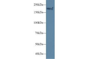 Detection of MYH1 in Mouse Serum using Polyclonal Antibody to Myosin Heavy Chain 1 (MYH1) (MYH1 antibody  (AA 1585-1642))