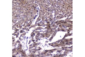 IHC analysis of ESRRG using anti-ESRRG antibody . (ESRRG antibody  (AA 302-458))