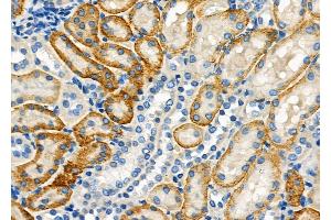 ABIN6265147 and ABIN6279144 at 1/100 staining Rat kidney tissue by IHC-P.
