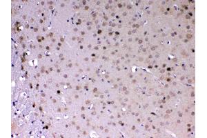 IHC analysis of MED18 using anti-MED18 antibody . (MED18 antibody  (AA 1-208))