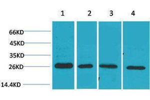 Western Blotting (WB) image for anti-SLUG antibody (ABIN3179037) (SLUG antibody)