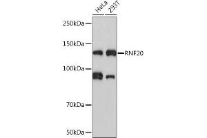 Western blot analysis of extracts of various cell lines, using RNF20 Rabbit mAb (ABIN7270071) at 1:1000 dilution. (RNF20 antibody)