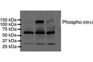Western blot analysis of phosphorylated ERN1 using ERN1 (phospho S724) polyclonal antibody .