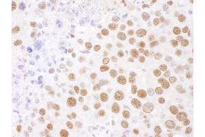 Immunohistochemistry (IHC) image for anti-Splicing Factor 3b, Subunit 4, 49kDa (SF3B4) (AA 374-424) antibody (ABIN7454988)