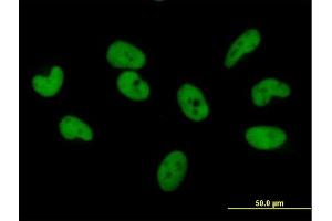 Immunofluorescence of purified MaxPab antibody to ZNF680 on HeLa cell. (ZNF680 antibody  (AA 1-530))