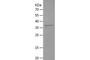 MBL2 Protein (AA 108-248) (His-IF2DI Tag)