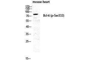 Western Blotting (WB) image for anti-B-Cell CLL/lymphoma 6 (BCL6) (pSer333) antibody (ABIN3182354)