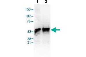 Western Blot (Cell lysate) analysis of (1) 25 ug whole cell extracts of Hela cells, (2) 25 ug nuclear extracts of Hela cells. (HDAC1 antibody  (C-Term))