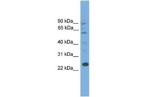WB Suggested Anti-BCL7A  Antibody Titration: 0. (BCL7A antibody  (Middle Region))