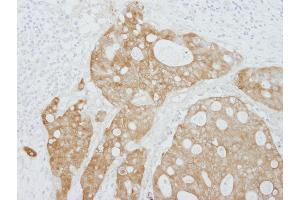 anti-Stratifin (SFN) (AA 198-248) antibody