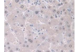 Detection of GDA in Human Liver Tissue using Polyclonal Antibody to Guanine Deaminase (GDA) (GDA antibody  (AA 1-454))