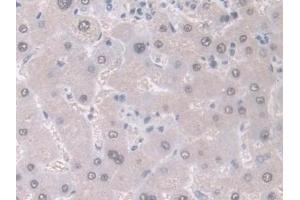 Detection of GDA in Human Liver Tissue using Polyclonal Antibody to Guanine Deaminase (GDA)