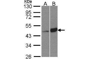 WB Image Sample(30 μg of whole cell lysate) A:HeLa S3, B:Raji, 10% SDS PAGE antibody diluted at 1:500 (BCKDK antibody)