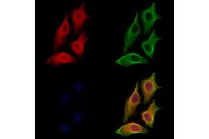 ABIN7094554 and ABIN7098603 staining HepG2 cells by IF/ICC.