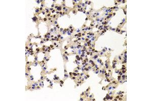 Immunohistochemistry of paraffin-embedded Mouse lung using PPAT antibody at dilution of 1:100 (x400 lens).
